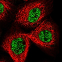 Invitrogen CCDC19 Polyclonal Antibody 100 &mu;L; Unconjugated:Antibodies,