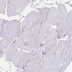 Invitrogen CCDC19 Polyclonal Antibody 100 &mu;L; Unconjugated:Antibodies,