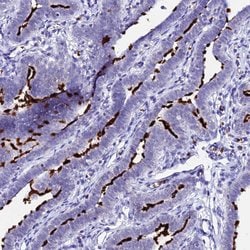 Invitrogen CCDC19 Polyclonal Antibody 100 &mu;L; Unconjugated:Antibodies,