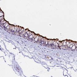 Invitrogen CCDC19 Polyclonal Antibody 100 &mu;L; Unconjugated:Antibodies,