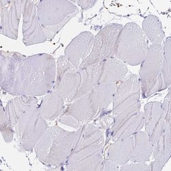 Invitrogen CCDC19 Polyclonal Antibody 100 &mu;L; Unconjugated:Antibodies,