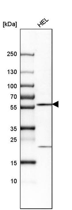 Invitrogen CCDC19 Polyclonal Antibody 100 &mu;L; Unconjugated:Antibodies,