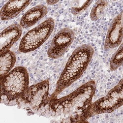 Invitrogen LOH12CR1 Polyclonal Antibody 100 &mu;L; Unconjugated:Antibodies,