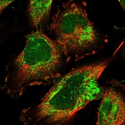 Invitrogen EARS2 Polyclonal Antibody 100 &mu;L; Unconjugated:Antibodies,