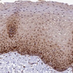 Invitrogen EARS2 Polyclonal Antibody 100 &mu;L; Unconjugated:Antibodies,