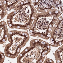 Invitrogen RBM42 Polyclonal Antibody 100 &mu;L; Unconjugated:Antibodies,