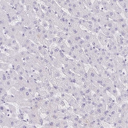 Invitrogen COL17A1 Polyclonal Antibody 100 &mu;L; Unconjugated:Antibodies,