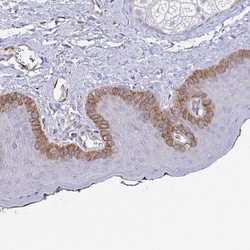 Invitrogen COL17A1 Polyclonal Antibody 100 &mu;L; Unconjugated:Antibodies,