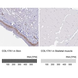 Invitrogen COL17A1 Polyclonal Antibody 100 &mu;L; Unconjugated:Antibodies,