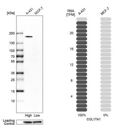 Invitrogen COL17A1 Polyclonal Antibody 100 &mu;L; Unconjugated:Antibodies,