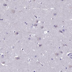 Invitrogen CRB2 Polyclonal Antibody 100 &mu;L; Unconjugated:Antibodies,