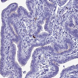 Invitrogen CRB2 Polyclonal Antibody 100 &mu;L; Unconjugated:Antibodies,