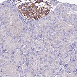 Invitrogen CRB2 Polyclonal Antibody 100 &mu;L; Unconjugated:Antibodies,
