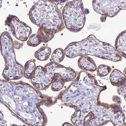 Invitrogen CRB2 Polyclonal Antibody 100 &mu;L; Unconjugated:Antibodies,