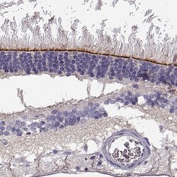 Invitrogen CRB2 Polyclonal Antibody 100 &mu;L; Unconjugated:Antibodies,