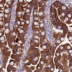 Invitrogen NLRP6 Polyclonal Antibody 100 &mu;L | Buy Online | Invitrogen&trade; | Fisher Scientific