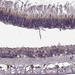 Invitrogen CABP5 Polyclonal Antibody 100 &mu;L | Buy Online | Invitrogen&trade; | Fisher Scientific