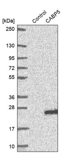 Invitrogen CABP5 Polyclonal Antibody 100 &mu;L | Buy Online | Invitrogen&trade; | Fisher Scientific