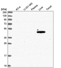 Invitrogen ACOT1 Polyclonal Antibody 100 &mu;L | Buy Online | Invitrogen&trade; | Fisher Scientific
