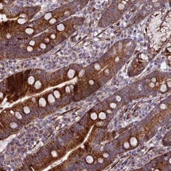 Invitrogen KBTBD7 Polyclonal Antibody 100 &mu;L | Buy Online | Invitrogen&trade; | Fisher Scientific
