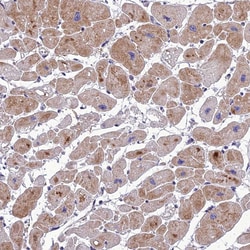 Invitrogen Adiponectin Receptor 2 Polyclonal Antibody 100 &mu;L; Unconjugated:Antibodies,