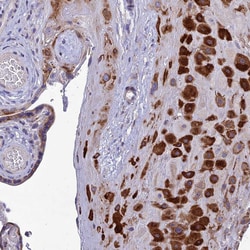 Invitrogen Adiponectin Receptor 2 Polyclonal Antibody 100 &mu;L; Unconjugated:Antibodies,