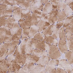Invitrogen Adiponectin Receptor 2 Polyclonal Antibody 100 &mu;L; Unconjugated:Antibodies,