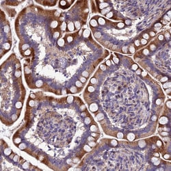 Invitrogen Adiponectin Receptor 2 Polyclonal Antibody 100 &mu;L; Unconjugated:Antibodies,