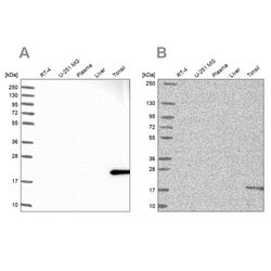 Invitrogen MZB1 Polyclonal Antibody 100 &mu;L; Unconjugated:Antibodies,