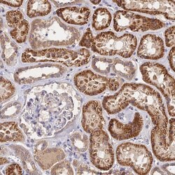 Invitrogen RANBP6 Polyclonal Antibody 100 &mu;L; Unconjugated:Antibodies,
