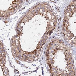 Invitrogen RANBP6 Polyclonal Antibody 100 &mu;L; Unconjugated:Antibodies,