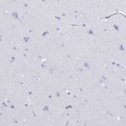 Invitrogen CRYBB2 Polyclonal Antibody 100 &mu;L | Buy Online | Invitrogen&trade; | Fisher Scientific