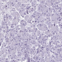 Invitrogen CRYBB2 Polyclonal Antibody 100 &mu;L | Buy Online | Invitrogen&trade; | Fisher Scientific