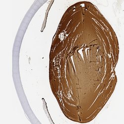 Invitrogen CRYBB2 Polyclonal Antibody 100 &mu;L | Buy Online | Invitrogen&trade; | Fisher Scientific