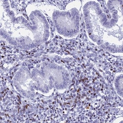Invitrogen PRPS1 Polyclonal Antibody 100 &mu;L; Unconjugated:Antibodies,