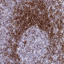 Invitrogen PRPS1 Polyclonal Antibody 100 &mu;L; Unconjugated:Antibodies,