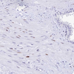 Invitrogen PRPS1 Polyclonal Antibody 100 &mu;L; Unconjugated:Antibodies,