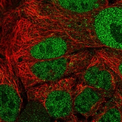 Invitrogen APOA1BP Polyclonal Antibody 100 &mu;L | Buy Online | Invitrogen&trade; | Fisher Scientific