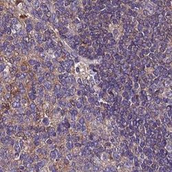 Invitrogen APOA1BP Polyclonal Antibody 100 &mu;L | Buy Online | Invitrogen&trade; | Fisher Scientific