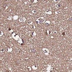 Invitrogen APOA1BP Polyclonal Antibody 100 &mu;L | Buy Online | Invitrogen&trade; | Fisher Scientific