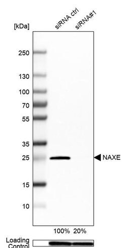 Invitrogen APOA1BP Polyclonal Antibody 100 &mu;L | Buy Online | Invitrogen&trade; | Fisher Scientific