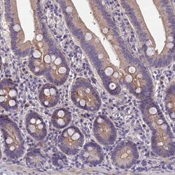 Invitrogen NT5M Polyclonal Antibody 100 &mu;L; Unconjugated:Antibodies,