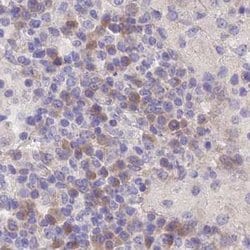Invitrogen FAM168B Polyclonal Antibody 100 &mu;L | Buy Online | Invitrogen&trade; | Fisher Scientific