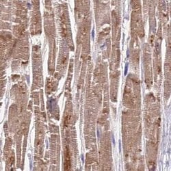 Invitrogen FAM168B Polyclonal Antibody 100 &mu;L | Buy Online | Invitrogen&trade; | Fisher Scientific