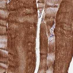 Invitrogen FAM168B Polyclonal Antibody 100 &mu;L | Buy Online | Invitrogen&trade; | Fisher Scientific