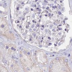 Invitrogen FAM168B Polyclonal Antibody 100 &mu;L | Buy Online | Invitrogen&trade; | Fisher Scientific