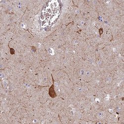 Invitrogen RHBDL2 Polyclonal Antibody 100 &mu;L; Unconjugated:Antibodies,