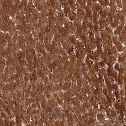 Invitrogen ISPD Polyclonal Antibody 100 &mu;L; Unconjugated:Antibodies,