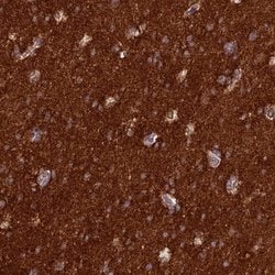 Invitrogen ST8SIA5 Polyclonal Antibody 100 μL; Unconjugated:Antibodies,