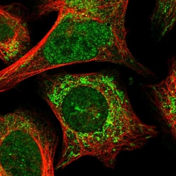 Invitrogen ANR52 Polyclonal Antibody 100 &mu;L; Unconjugated:Antibodies,